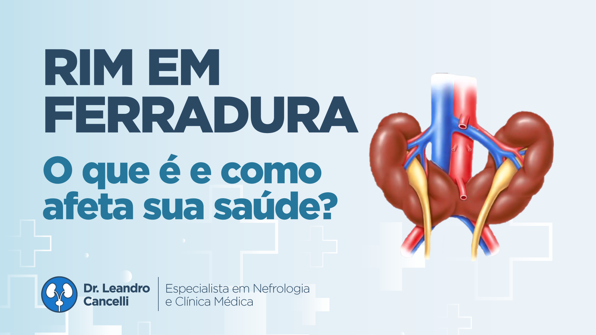 Rim em Ferradura: O que é e como afeta sua saúde?
