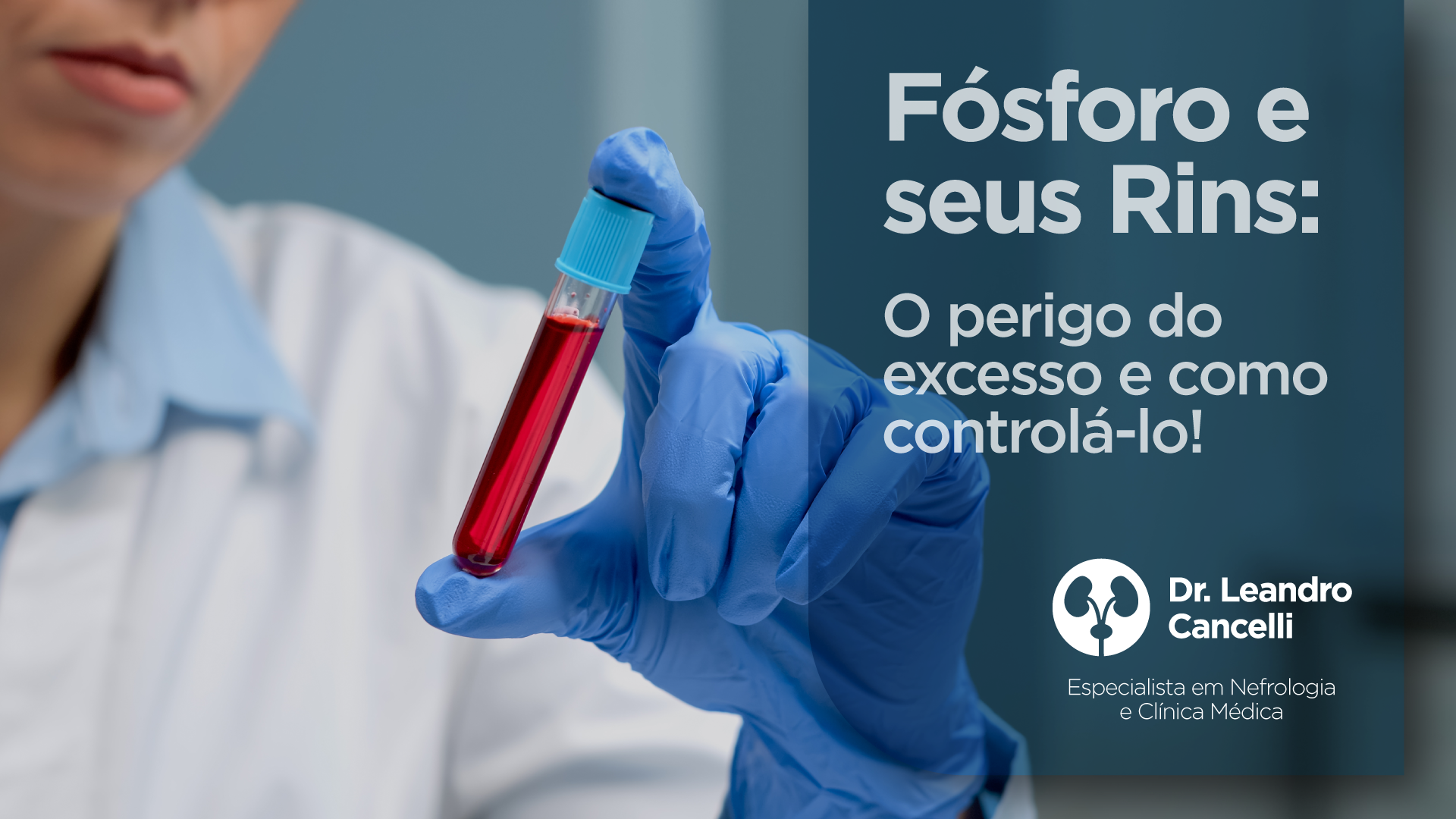 Fósforo e Seus Rins: O Perigo do Excesso e Como Controlá-lo!