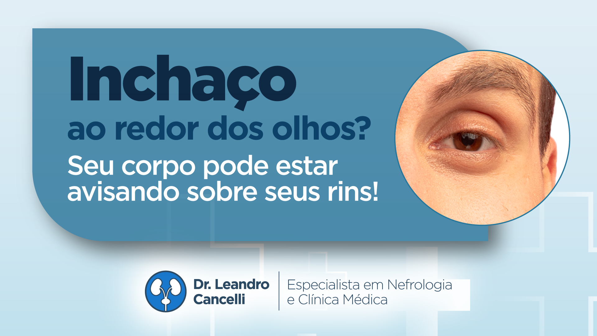 Inchaço ao Redor dos Olhos? Seu Corpo Pode Estar Avisando sobre Seus Rins!