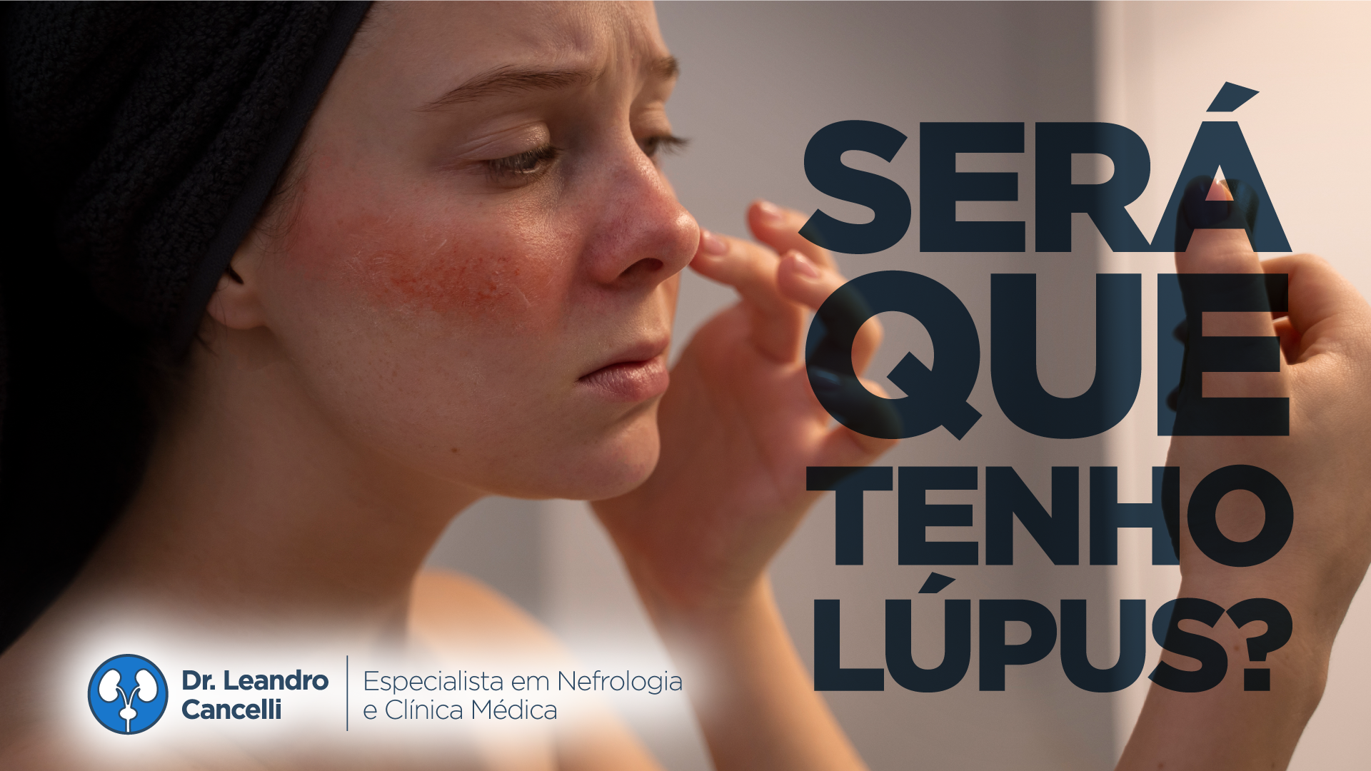 Será que Tenho Lúpus?
