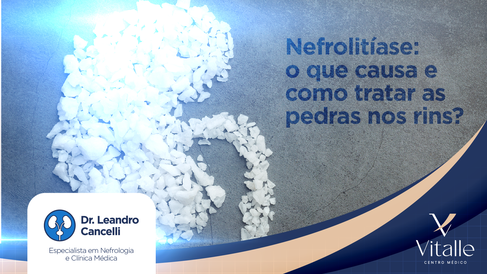 Nefrolitíase: causas, sintomas e tratamentos das pedras nos rins